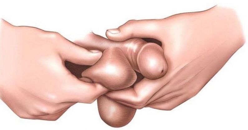 Pourquoi les couilles des hommes démangent-elles 